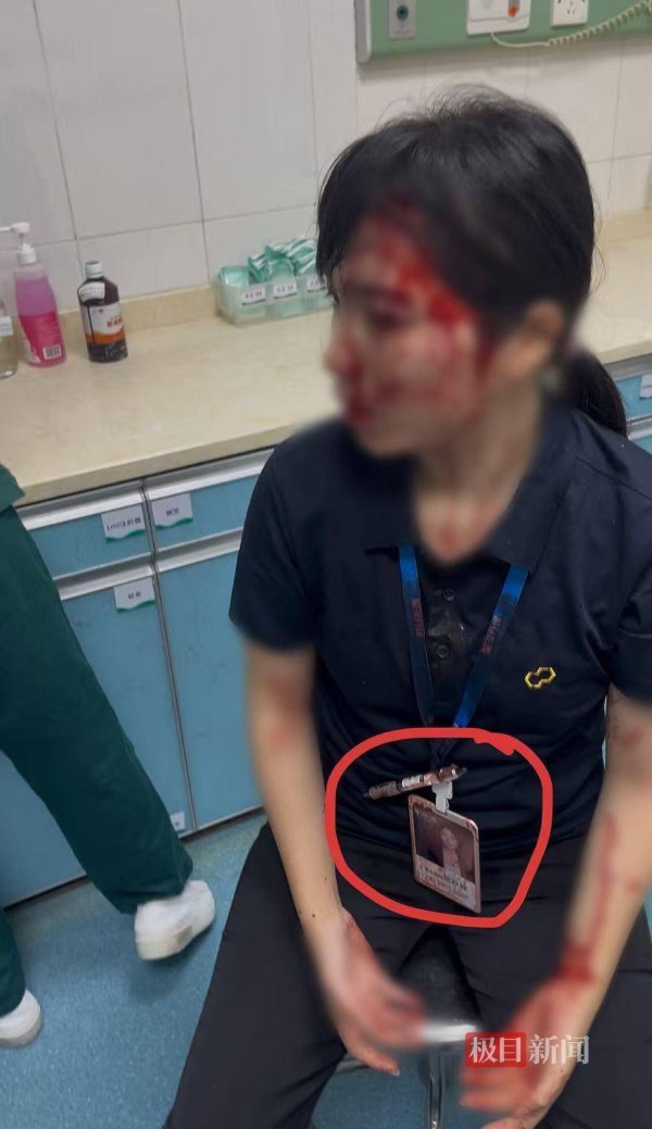 申宝证券 “男子持水杯砸伤女同事被刑拘”后续：脸部缝20多针的女子已出院，否认抢单惹祸